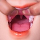 Doll Senior ヘッド柔らかさオプション 軟性シリコンヘッド+口開閉＆口腔模擬