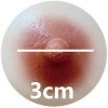 XT 乳輪サイズ 3CM