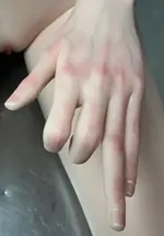 Yearndoll 指関節 あり
